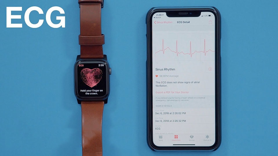 Tính năng đo ECG trên Apple Watch nay đã hỗ trợ trên 20 quốc gia.