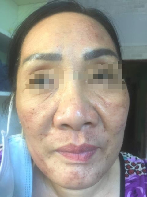 Hình 3