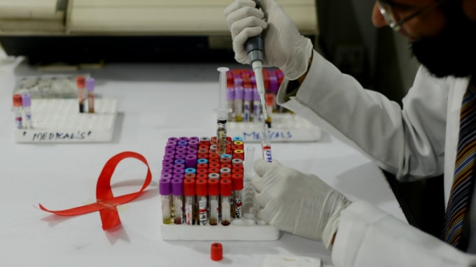 Đã tìm ra phương pháp có thể điều trị dứt điểm HIV. Ảnh minh họa.