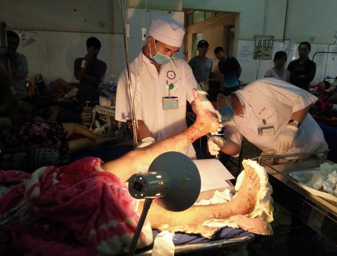 Ca phẫu thuật nối thành công 2 cẳng chân bị chém đứt lìa cho một nam thanh niên tại Bệnh viện Đa khoa vùng Tây Nguyên (ảnh Báo Đắk Lắk)