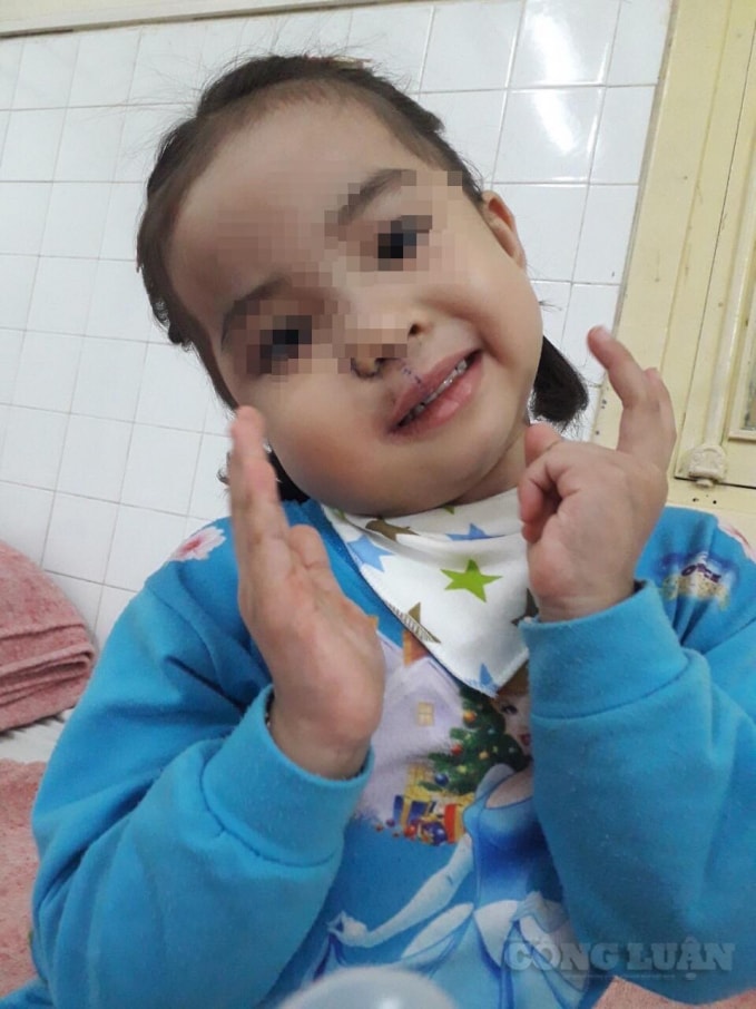 Sau ca phẫu thuật, bệnh nhi Ng. đã hồi phục sức khỏe hoàn toàn, có thể đi học trở lại trong thời gian tới.