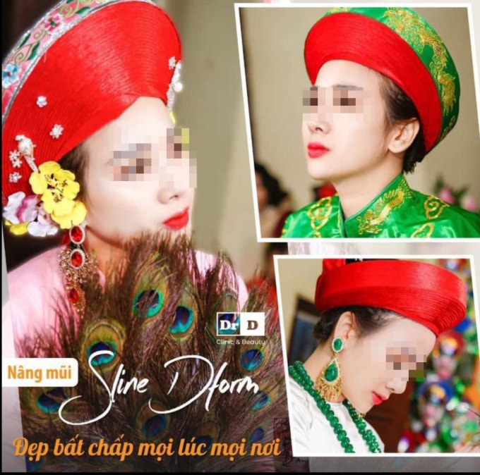 Thẩm mỹ DrD tự ý sử dụng hình ảnh cá nhân để quảng cáo dịch vụ nâng mũi (Ảnh chụp màn hình).