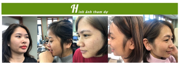 Cuộc thi đã nhận được khá nhiều ảnh dự thi của chị em