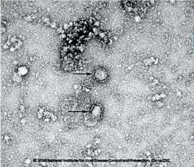 Cận cảnh loại virus đang gieo rắc nỗi lo sợ cho người dân Trung Quốc nói riêng và toàn thế giới nói chung. Ảnh: Viện Vi sinh thuộc Học viện Khoa học Trung Quốc.