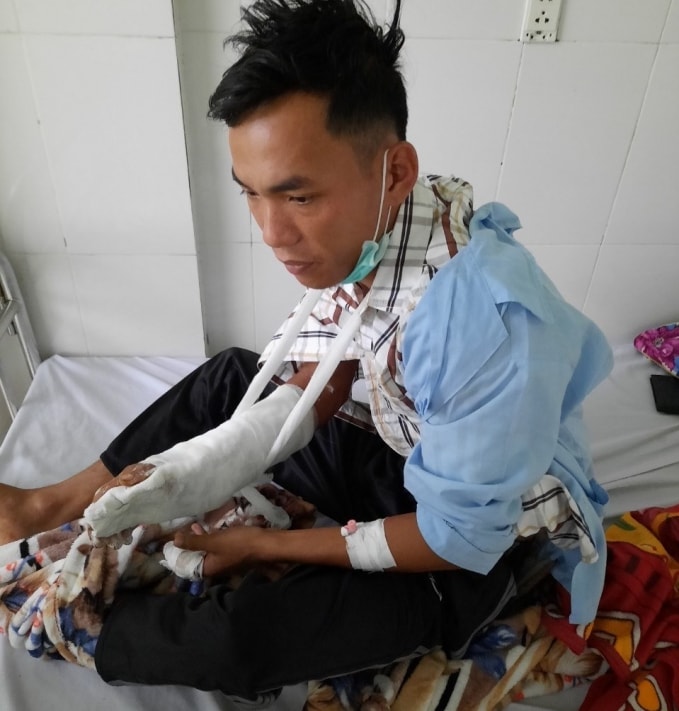 Anh Nguyễn Quang Đỗ đang được điều trị tại Bệnh viện Quân y 211 tỉnh Gia Lai.