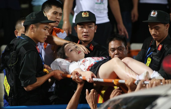 Quả pháo sáng được bắn ra trúng vào đùi trái của chị Tô Huyền Anh gây thương tích.