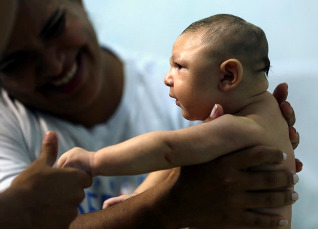 Em bé sơ sinh bị tật đầu nhỏ - Ảnh: Reuters.