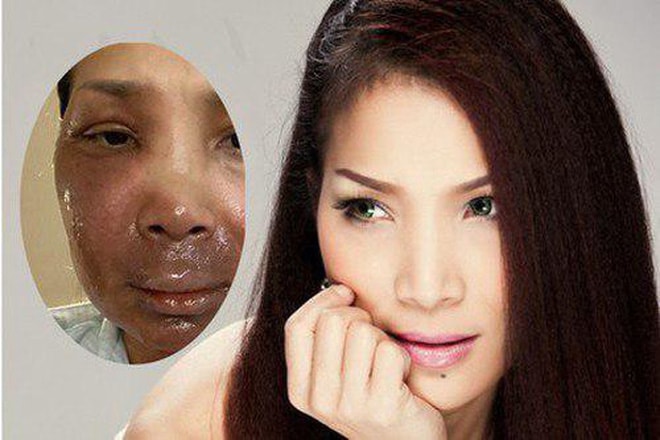 hồng ngọc2