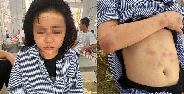 Cô gái bị hành hung suốt 2 giờ ở Yên Bái. Ảnh: TL.