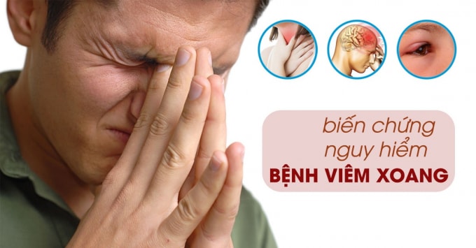 benh-viem-xoang-la-gi-nguy-hiem-ra-sao
