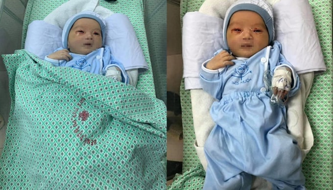 Bé sơ sinh bị bỏ rơi dưới hố ga đã tử vong. Ảnh: TL.