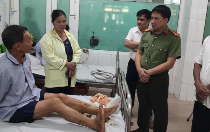 Ông Phạm Trung Kiền (công an viên) bị chém đứt gân chân, mẻ xương chân. Ảnh: CA.