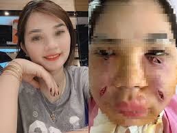 Hậu quả của việc làm đẹp tại cơ sở không uy tín