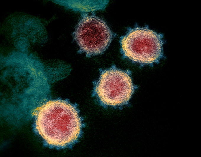 Hình ảnh virus SARS-CoV-2 được phân tích bởi kính hiển vi điện tử. Ảnh minh hoạ