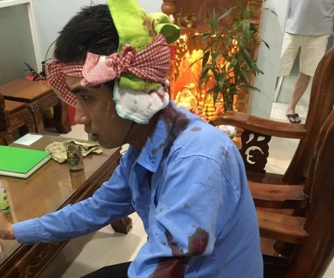 Nạn nhân bị thương ở vùng đầu. Ảnh: TL.