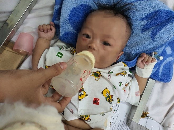 Cháu K. nhập viện với khuôn mặt bầm tím. Ảnh: TL.
