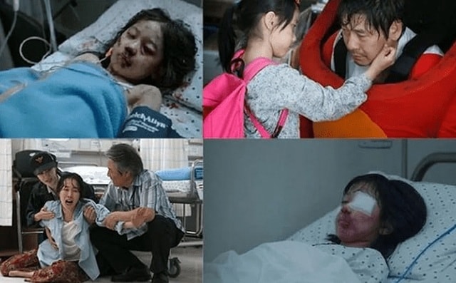 Nayoung bị hỏng toàn bộ đường ruột, phải phẫu thuật nhiều lần để phục hồi nội tạng, mất hậu môn, 80% âm đạo, giảm thị lực, viêm mũi, viêm màng nhĩ, dập xương mũi, và phải đeo hậu môn ngoài cả phần đời còn lại. (Những hình ảnh trong phim 