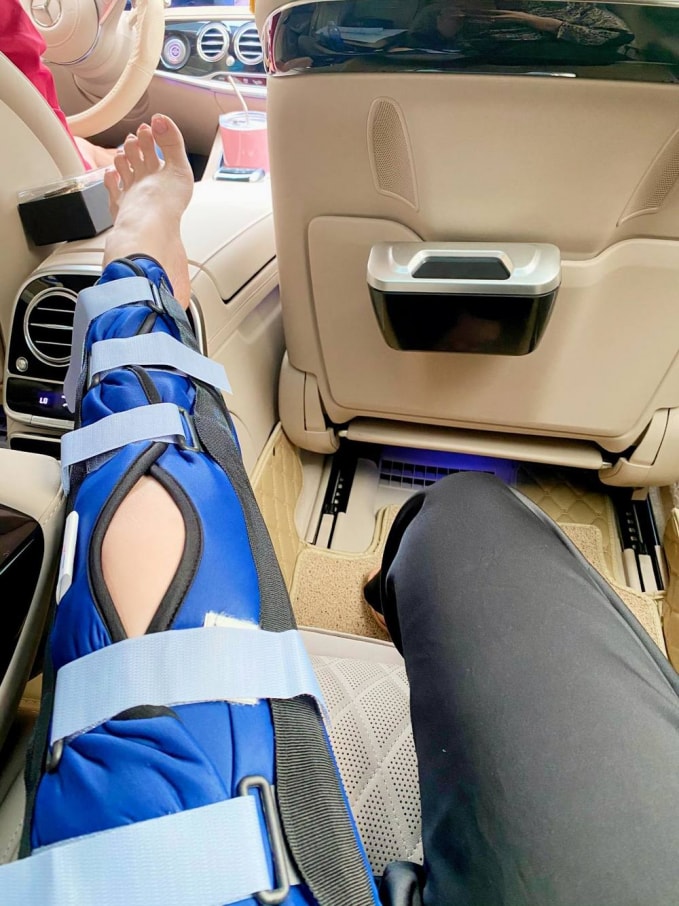 Phần chân hiện tại phải nẹp cố định như thế này. (Ảnh: FBNV)