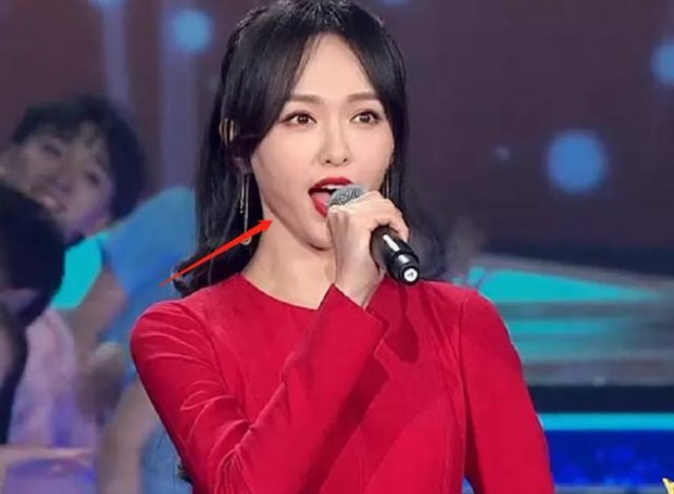 Đường Yên lộ rõ cằm nọng. Sau khi bầu bí và sinh con, người đẹp tăng cân khá nhiều
