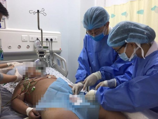 Các bác sĩ nỗ lực cấp cứu, giúp bệnh nhi vượt qua cơn nguy kịch. Ảnh: dantri.vn