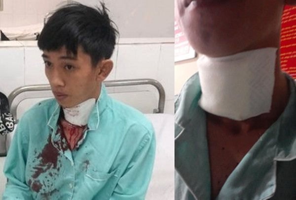 Anh Phan Hoàng Giang bị đối tượng cứa cổ, cướp tài sản nhưng bất thành.