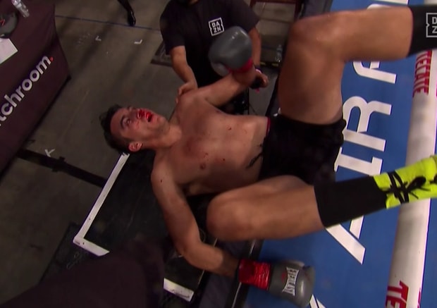 Tay đấm Fernandez đã bị hạ Knock-out ở hiệp 3. Ảnh: internet