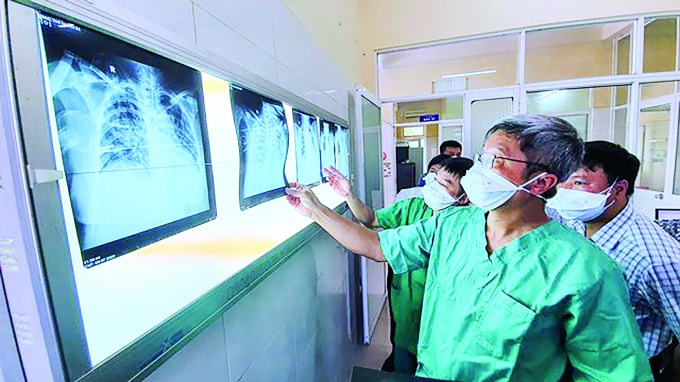 Thứ trưởng Nguyễn Trường Sơn kiểm tra phim chụp của bệnh nhân tại BV Phổi Đà Nẵng.