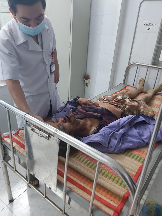 Hiện người đàn ông bị voi rừng tấn công đang được các y bác sĩ điều trị tích cực. Ảnh: tienphong.vn