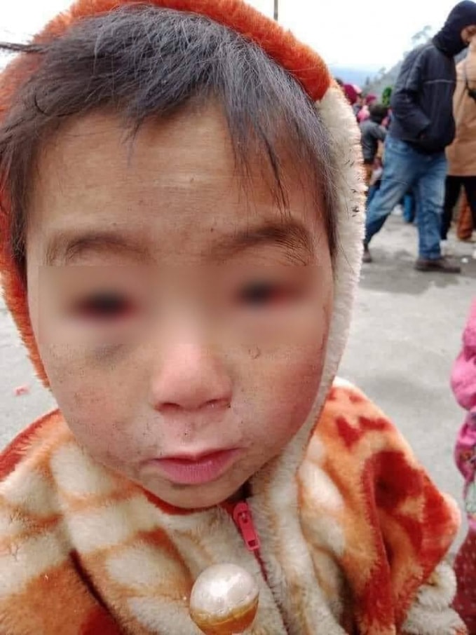 Đôi mắt đỏ ngầu vì cái rét cắt da cắt thịt.