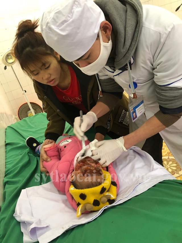 Bé M.B.T. được chăm sóc vết thương. Ảnh: Sở y tế Lào Cai