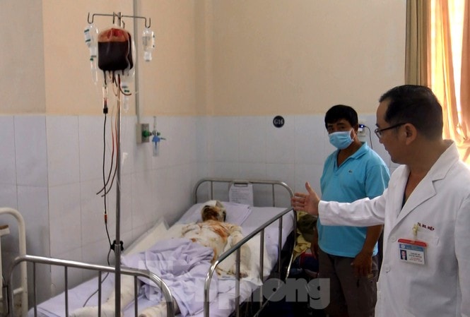 Thanh niên cụt tay, mất một mắt do pháo nổ. Ảnh: tienphong.vn