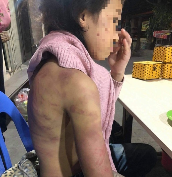 Cháu B. bị bạo hành, xâm hại suốt một thời gian dài.