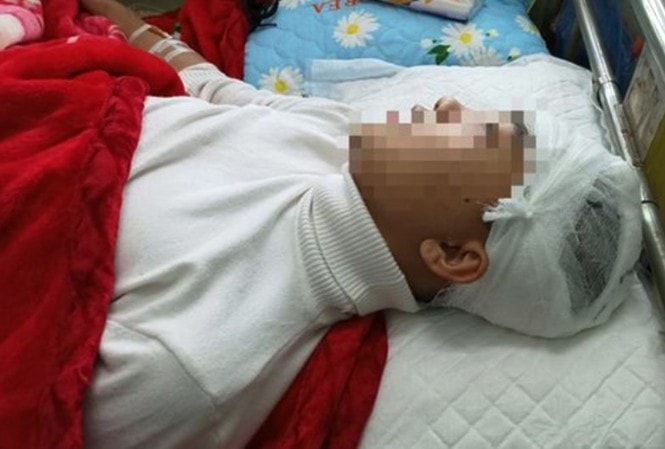 Phan Thanh L. bị đánh. Ảnh: tienphong.vn