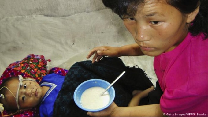 Nạn đói và suy dinh dưỡng đã từng xảy ra ở Bắc Triều Tiên trước thời kỳ kinh tế kiệt quệ như hiện nay.