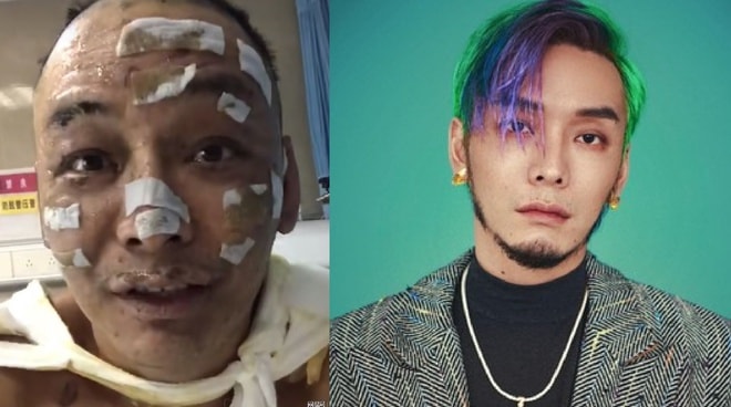 Người hâm mộ Cbiz vô cùng lo lắng trước thông tin nam rapper Từ Chân Chân gặp hoả hoạn thương tâm.