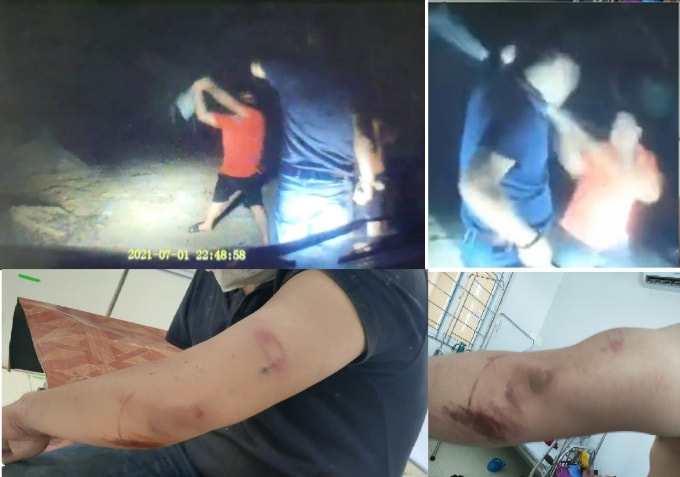 Công an huyện Đức Thọ (Hà Tĩnh) đã xác định rõ 2 đối tượng trực tiếp tấn công phóng viên là Nguyễn Văn An và Đào Nhật Vũ ở xã An Dũng, Đức Thọ.