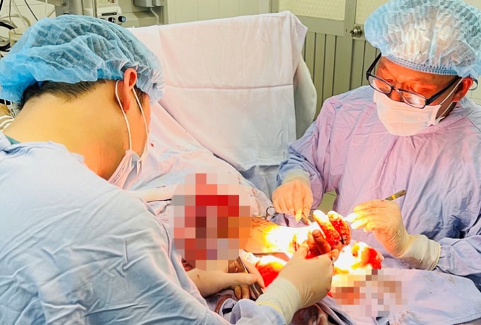 Ca mổ nối bàn tay cho anh N.Đ.P. (Ảnh: BVCC)
