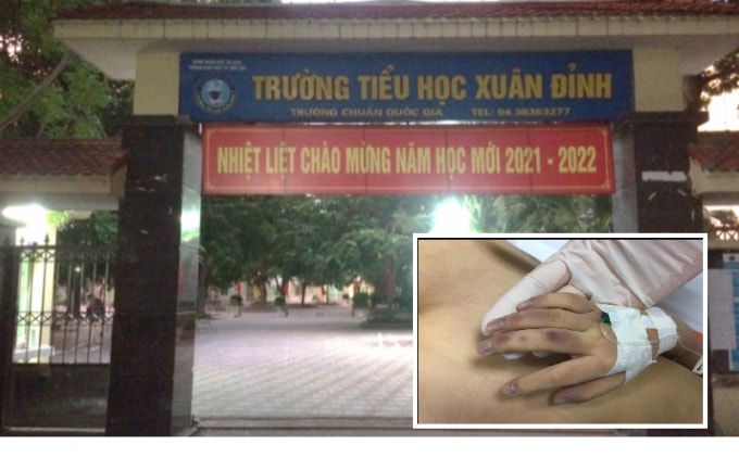 bo de khai gi trong vu be gai 6 tuoi tu vong hinh 1