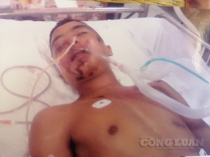 vu tngt tai dong hoi co quan csdt cong an tp dong hoi co dau hieu vi pham to tung nghiem trong hinh 1