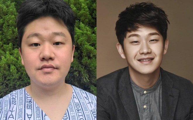 ca si xu han thua nhan gia mac ung thu de keu goi tu thien hinh 1