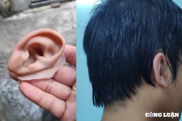 hai chang trai hon 4 nam theo duoi nghe lam mui tay chan gia cho nguoi khiem khuyet hinh 9
