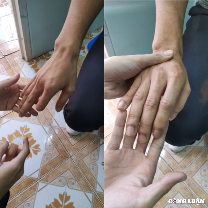 hai chang trai hon 4 nam theo duoi nghe lam mui tay chan gia cho nguoi khiem khuyet hinh 4