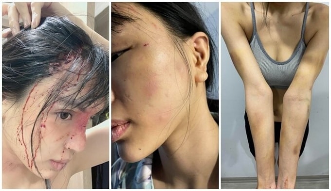 nguoi mau kha trang bi bao hanh da man hinh 1