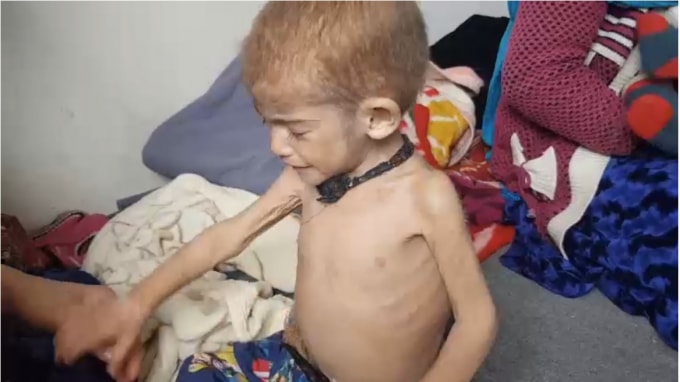 nan doi dang hoanh hanh o afghanistan hinh 1