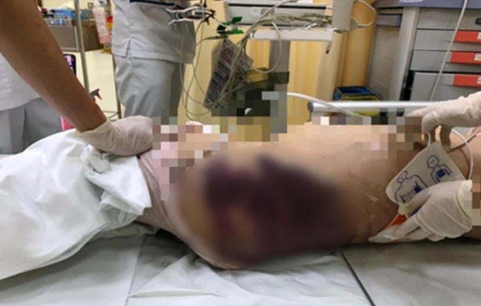 loi khai cua di ghe danh con chong den tu vong lieu ba ruot cua nan nhan co la dong pham hinh 3