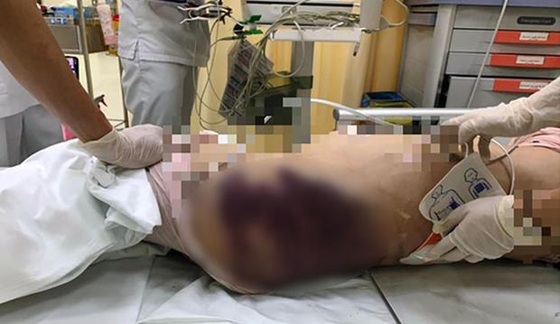 chuyen ho so vu be 8 tuoi nghi tu vong do di ghe bao hanh len cong an tp hcm hinh 2