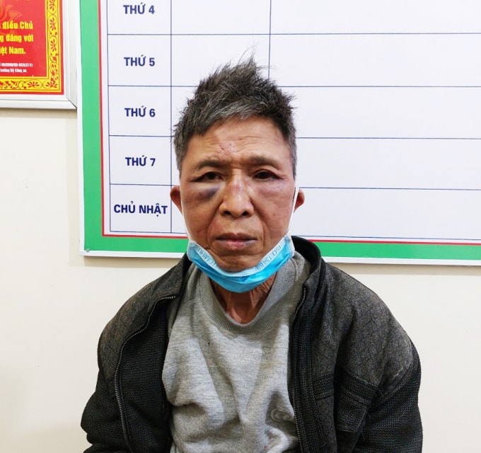 3 chien si cong an o ha giang bi thuong khi truy bat toi pham ma tuy hinh 1
