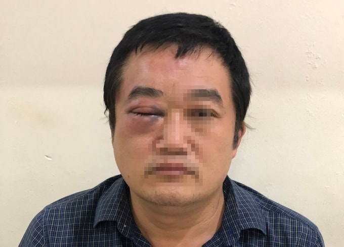 giam doc bi hanh hung vi mau thuan tien bac hinh 2