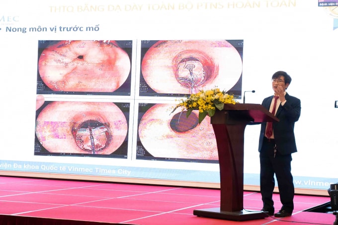 tien bo cua phau thuat noi soi trong dieu tri ung thu thuc quan tai viet nam hinh 3