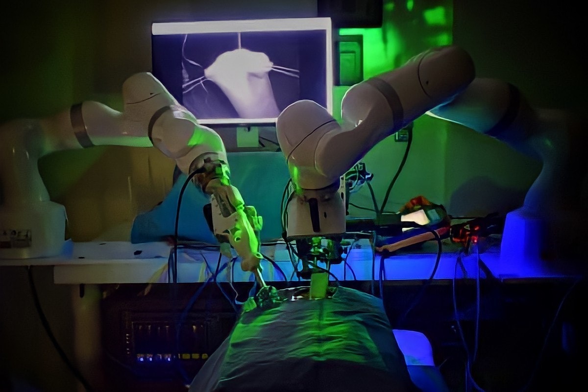 robot tai my thuc hien mo noi soi khong can su tro giup cua con nguoi hinh 1